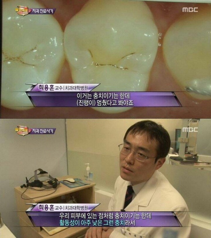 치과 치료의 진실 | 인스티즈