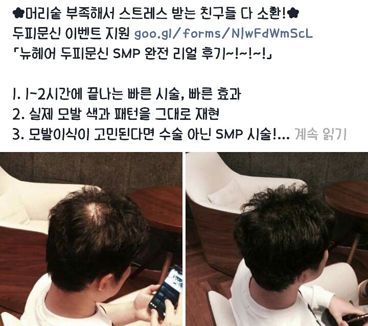탈모인들 희소식 | 인스티즈