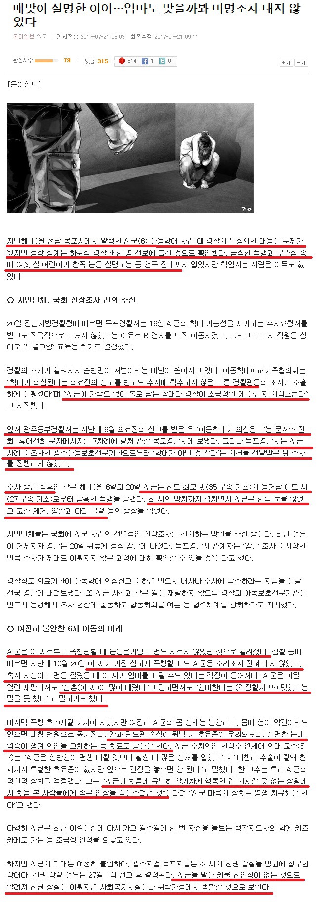 동거남의 폭행으로 한쪽 눈실명,고환제거 당한 6세 아이..jpg | 인스티즈