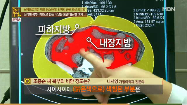 침묵의 암살자 뱃속의 시한폭탄 내장지방의 위험성 | 인스티즈