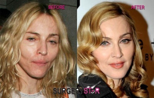 미국에서 많이하는 성형수술 세가지 | 인스티즈