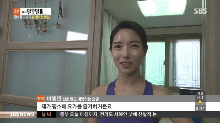 탈모가 고민인 여성 모델 | 인스티즈