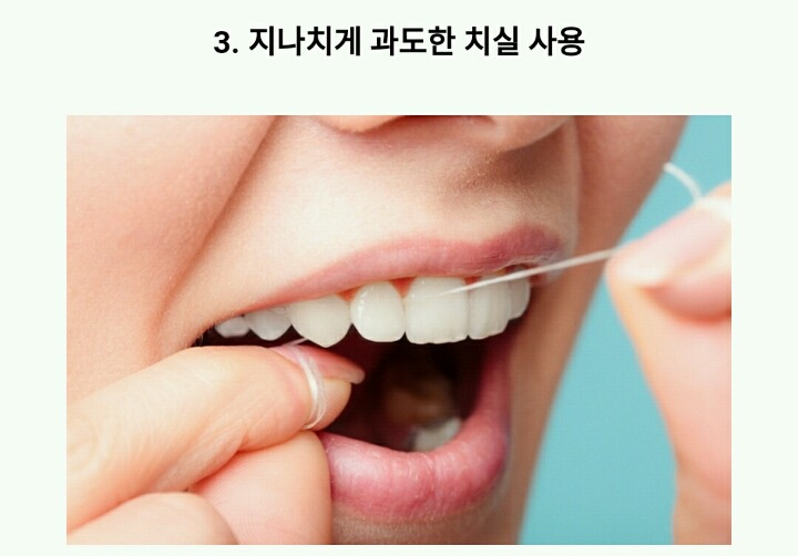 ＜정보치아를 누렇게 만드는 나쁜 습관에 8가지 | 인스티즈