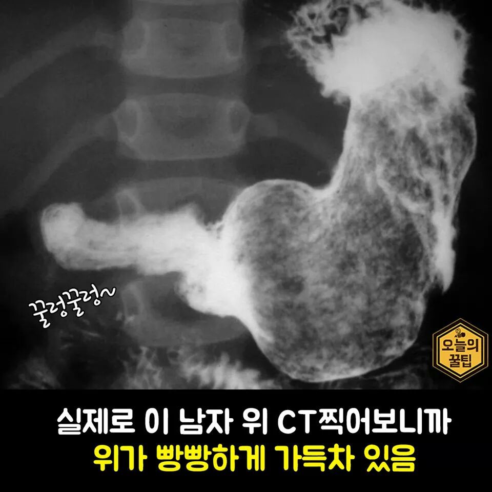 여자들이 밥먹고 또 간식을 먹는이유 | 인스티즈