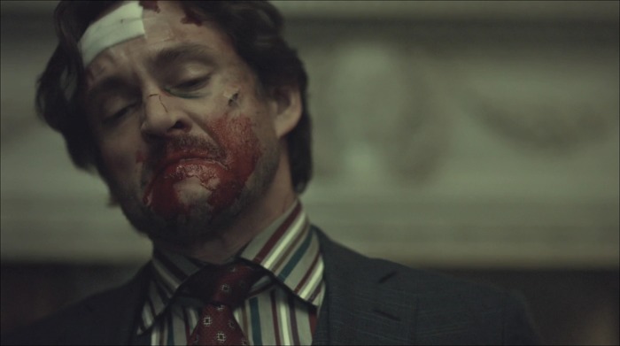 [로맨틱스릴러미드] 한니발 (Hannibal) 시즌3 에피7 (2/4) | 인스티즈
