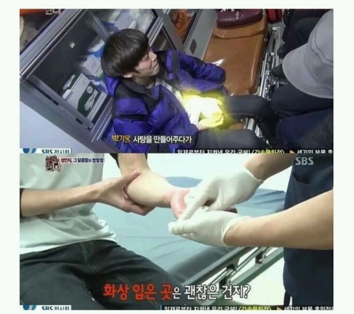 여자친구한테 줄 사탕만들다가 화상입은 남자친구 | 인스티즈