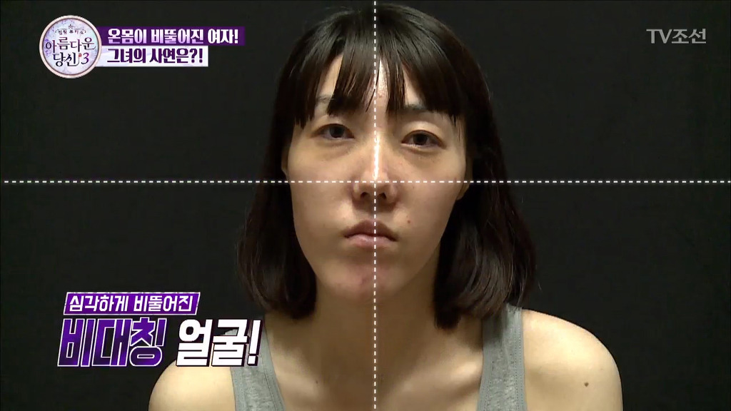 부정교합을 방치하면 안되는 이유 | 인스티즈