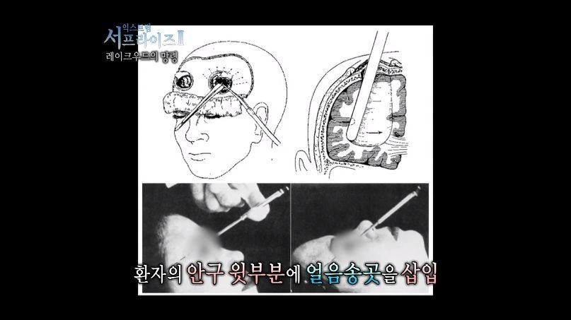 [서프라이즈] 잘못된 수술 레이크우드의 망령.jpg | 인스티즈