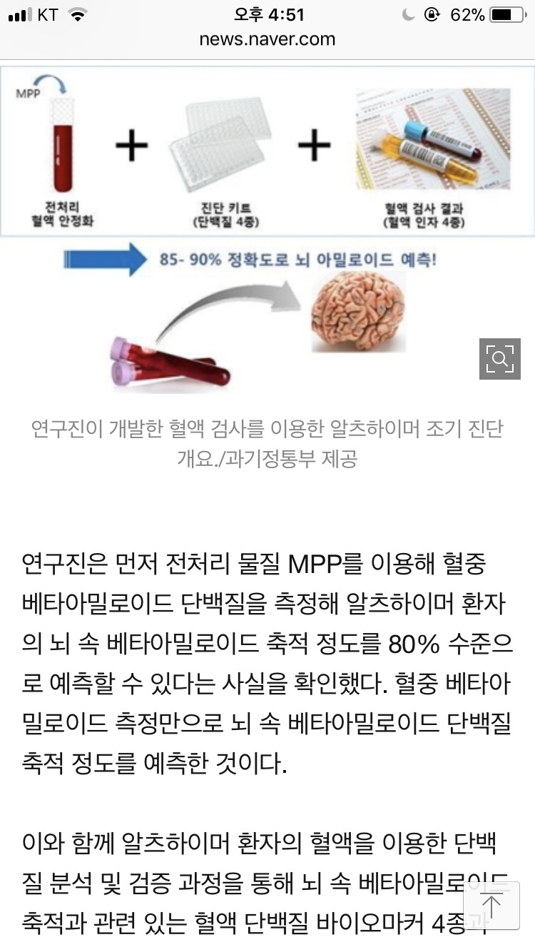 혈액검사만으로 치매 조기 진단...정상인 치매 예측 길 열었다 | 인스티즈