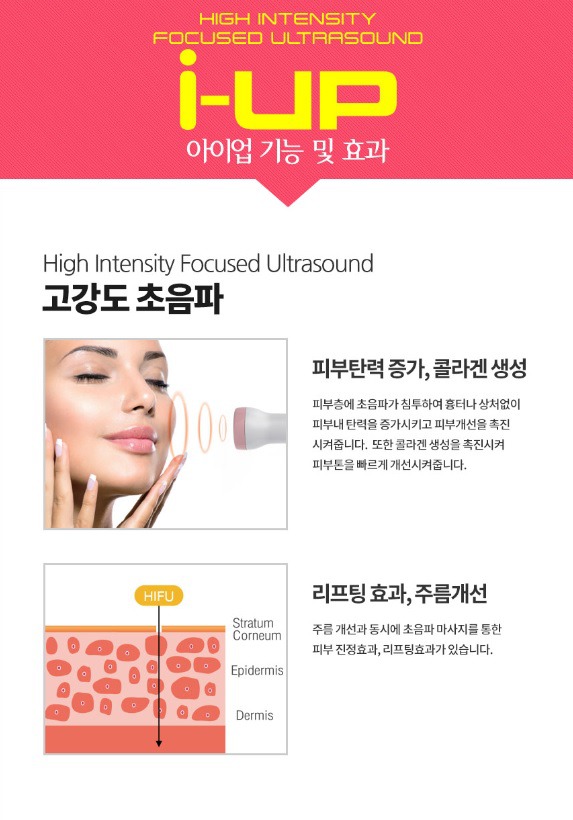 아이업 이미지