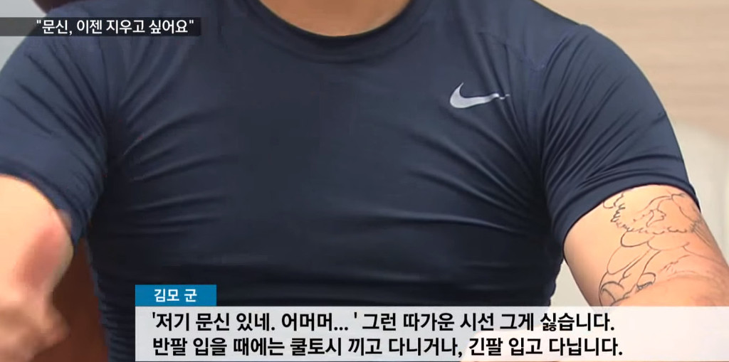 문신, 이제 지우고 싶어요! | 인스티즈